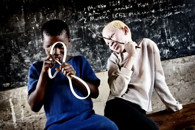 Los albinos de África, una Maldición