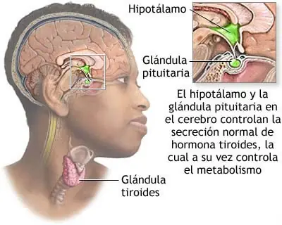Una enfermedad común y silenciosa: Hipotiroidismo
