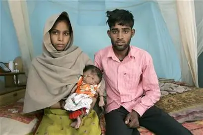 Nace niña con dos caras en la india