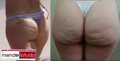 Tipos de Culos.. Elegi el tuyo