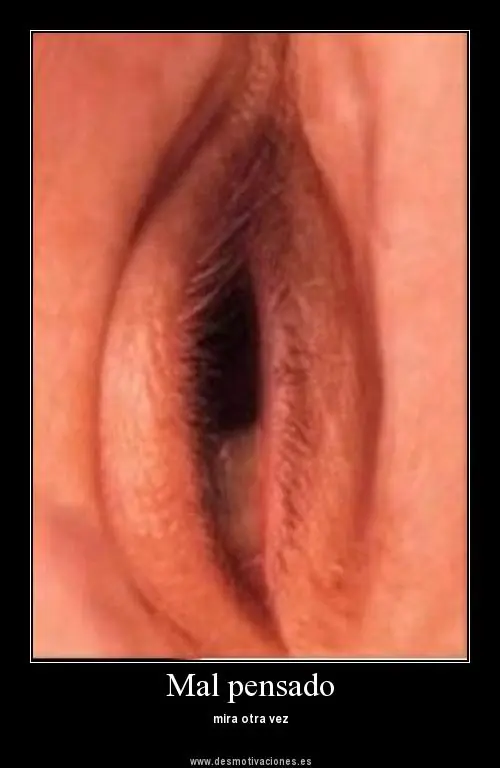 imagenes