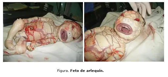 comentar es agradecer