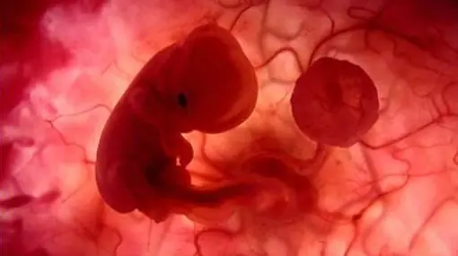 Desmintiendo "Consecuencias del aborto en la mujer"