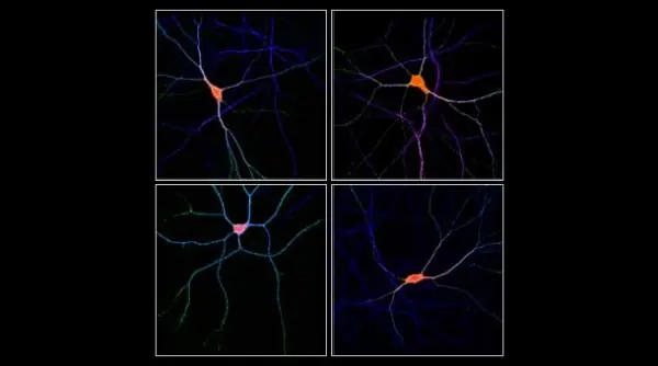 Hallan proteínas para entender la bipolaridad