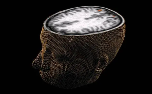 descubren zona del cerebro que ayudaría a predecir crímene