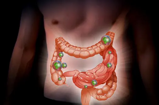 ¿Cómo recuperar nuestra flora intestinal?