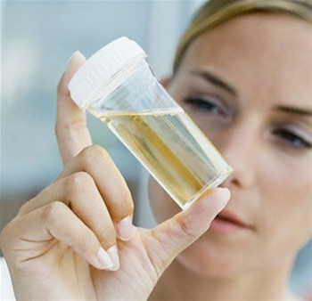 Uroterapia o unirnoterapie una alternativa de salud