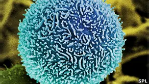 El cáncer aumentará en 75% para 2030, predice la OMS