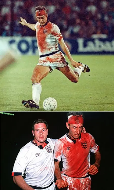 Terry Butcher, Jugó 90 minutos bañado en sangre....