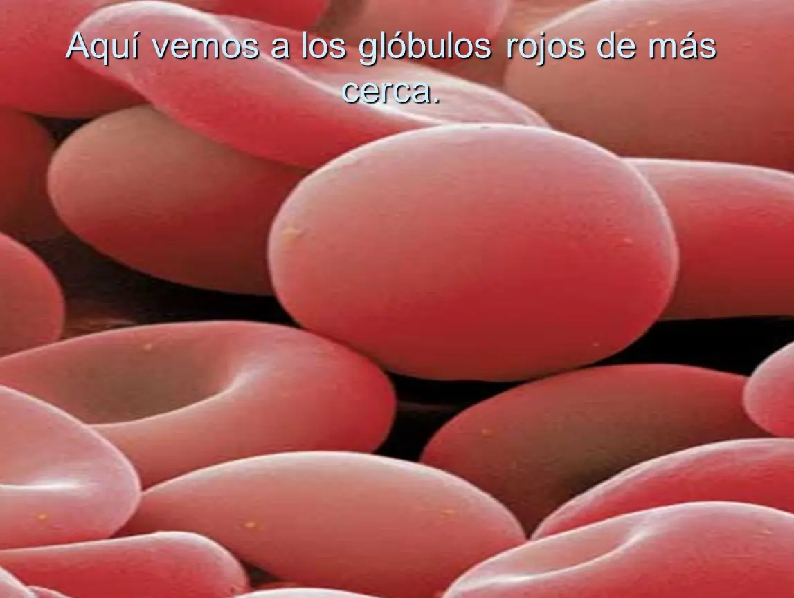 papilas