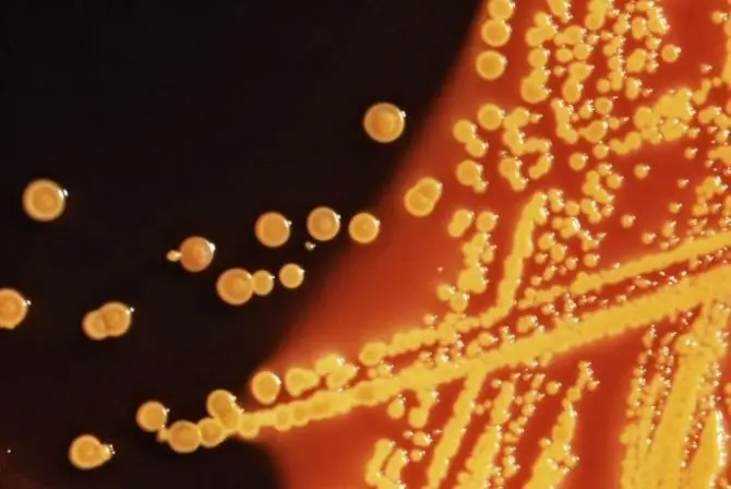 Bacterias "adictas" a la cafeína.