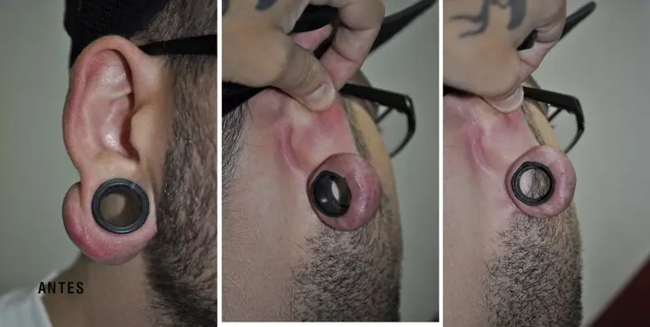 Top 6 expansores infectados