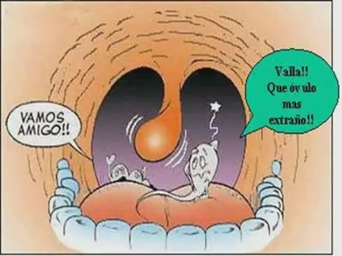 Imágenes Divertidas MeGaPoSt