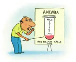 anemia