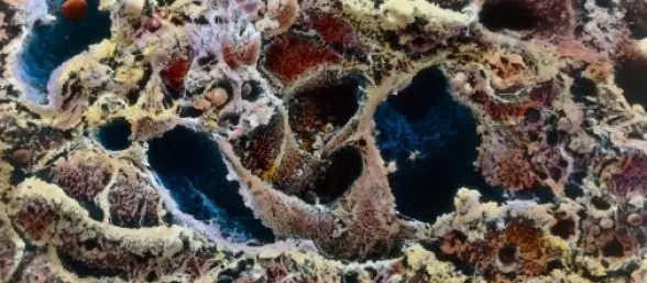 Solucion para el cancer de piel: inventan un parche