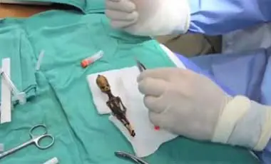 Extraterrestre chileno era humano