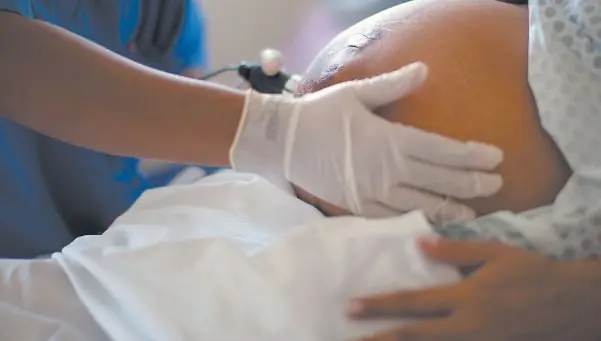 Síndrome X-frágil, un mal calificado como "raro"