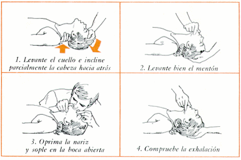 Drogas. Que hacer ante una sobredosis.