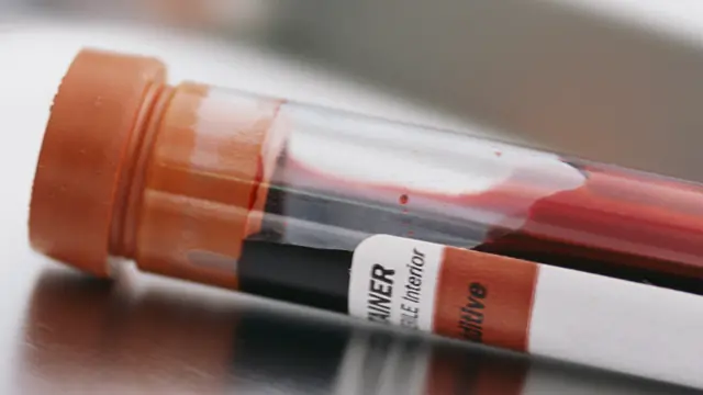 Qué deberías saber sobre los análisis de sangre