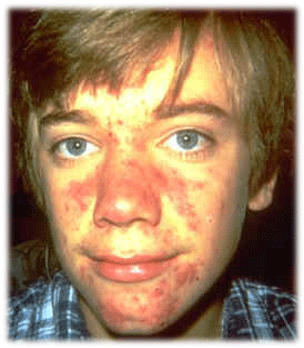 ¿Por Que Somos Feos? [5 Motivos-5 Soluciones]