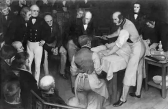 Los cuatro casos famosos de Robert Liston!!