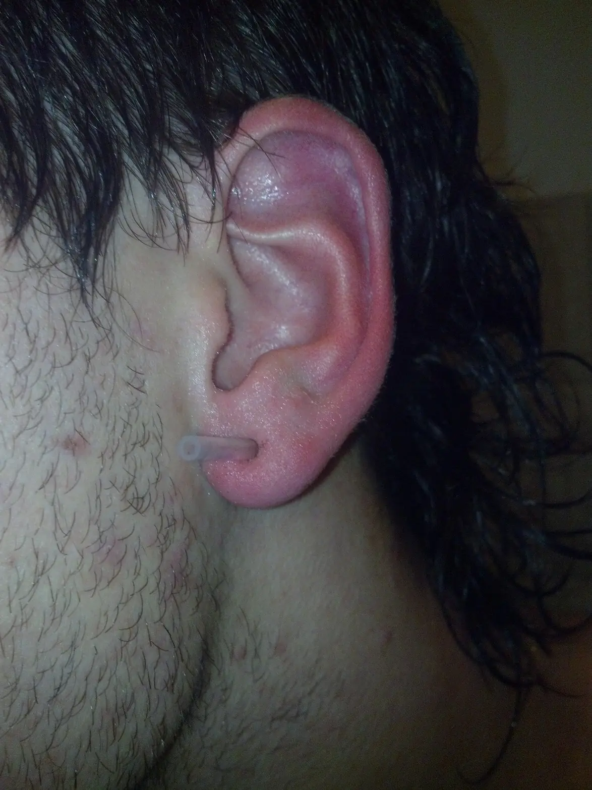 Expandite la oreja por 2 pesos.