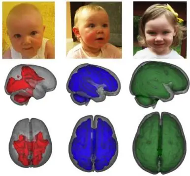 El cerebro de los bebés que toman el pecho se desarrolla m