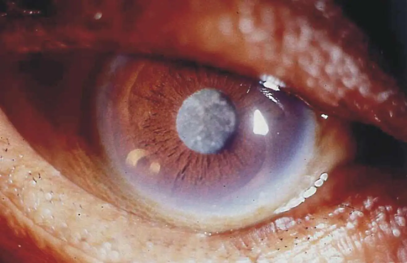Ojo con los ojos!