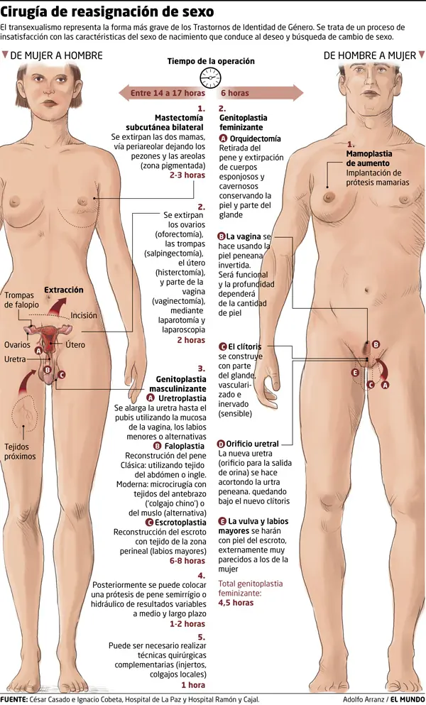 Realizan la primera operación de cambio de sexo a una mujer