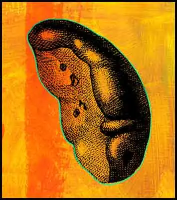 ¿Que Es La Cirrosis?