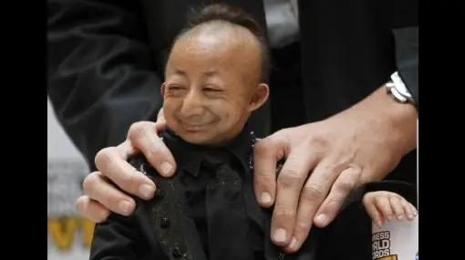 El hombre mas pequeño del mundo.