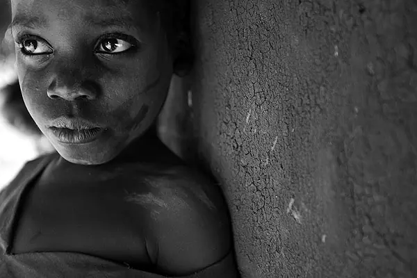 La pobreza: Niños trabajajando,desnutridos, sus juguetes.