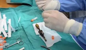 El misterio del alienígena liliputiense