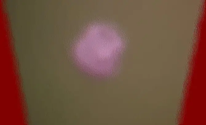 Hacia un posible tratamiento farmacológico para eliminar la