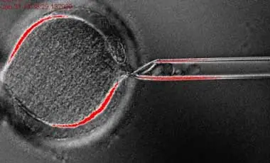 Crean por primera vez células madre humanas por clonación