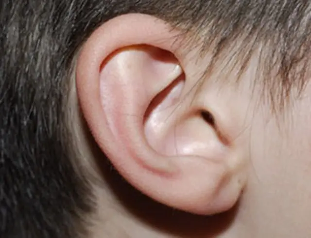 Como mover las orejas