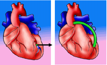 Lo atamo con alambre? No, inventos argentinos