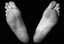 ¿Por qué huelen los pies?