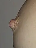 que es una teta??