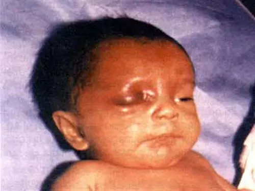 Los niños,víctimas de la violencia doméstica