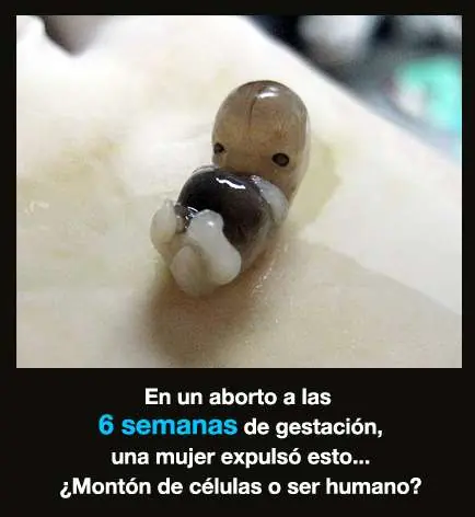 28 razones contra el aborto para progresistas