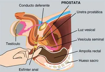 Masaje de próstata