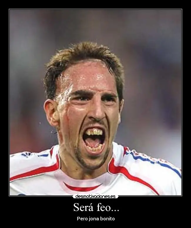 ¿ Porque Ribery Es Feo ?