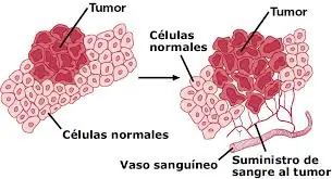 Inventan Bisturi que Puede Oler el Cancer