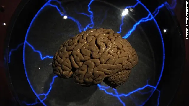 Implante de un microchip en el cerebro podría ayudar a recu