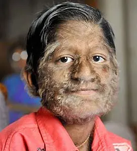 hombre lobo