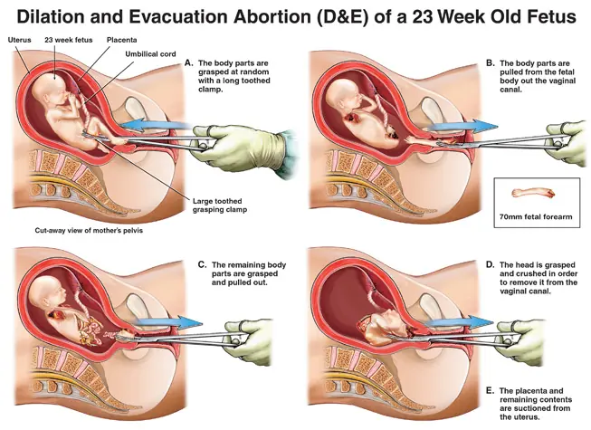 Rockefeller promueve y financia el Aborto