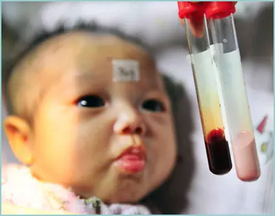 Sangre de Color Rosa