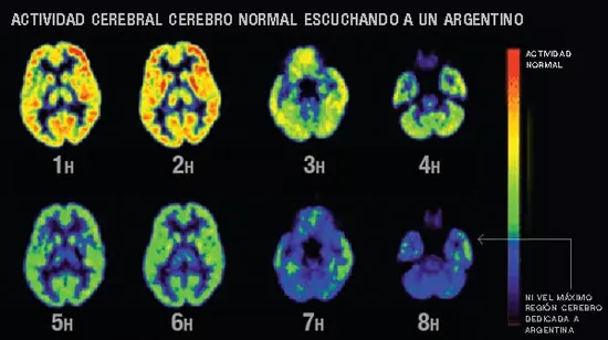 El cerebro humano puede soportar a un argentino hablando ...