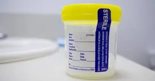 Colores y olores de la orina, buenos indicadores de salud